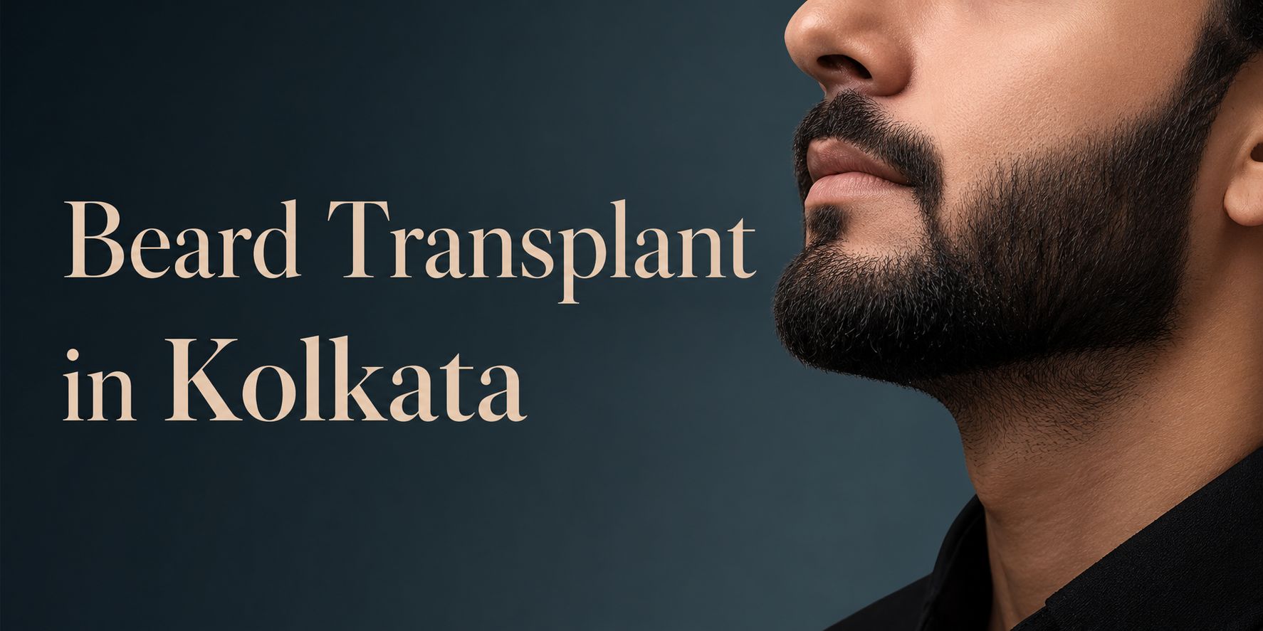 Beard Transplant in Kolkata