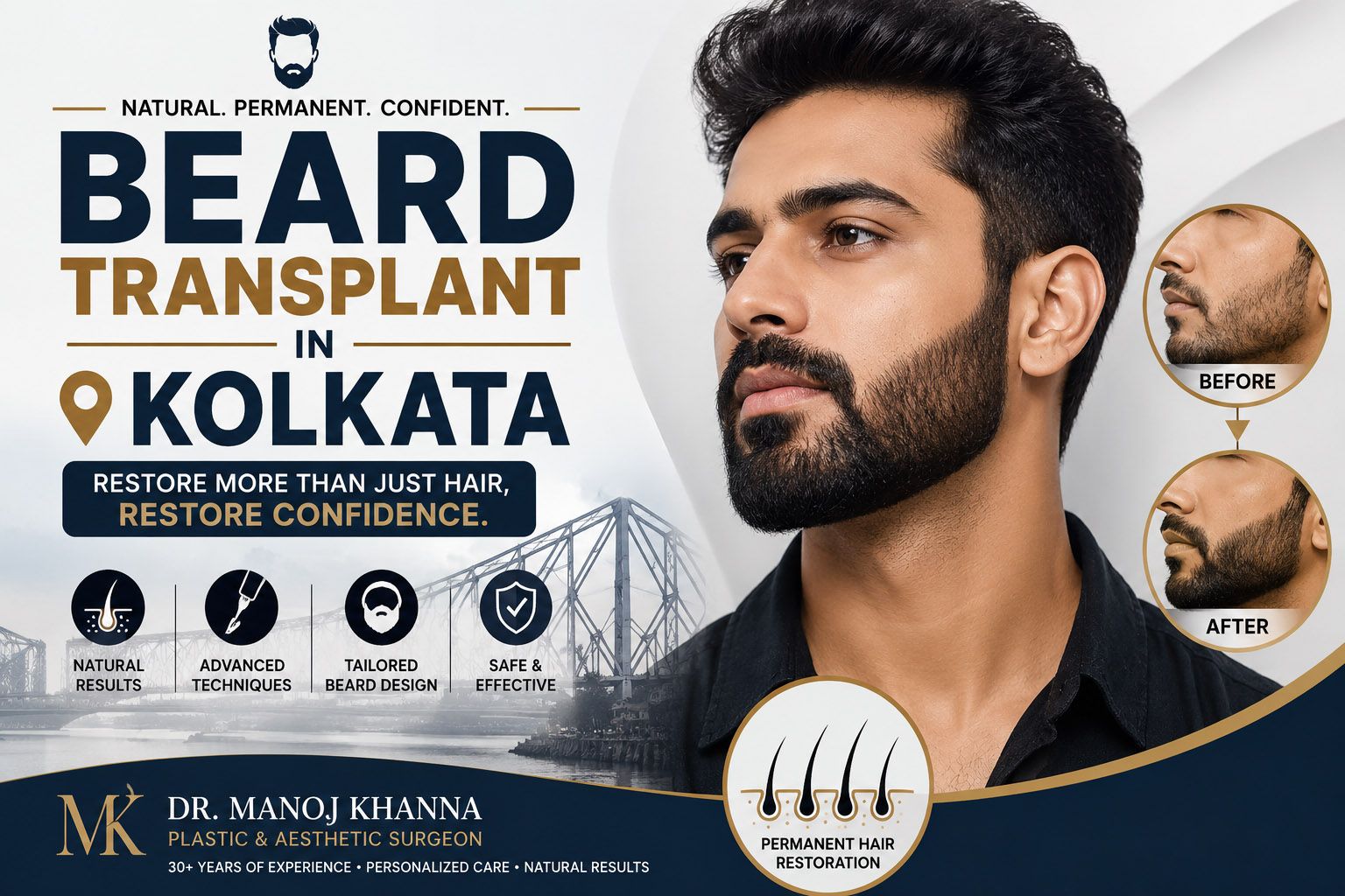Beard Transplant In Kolkata