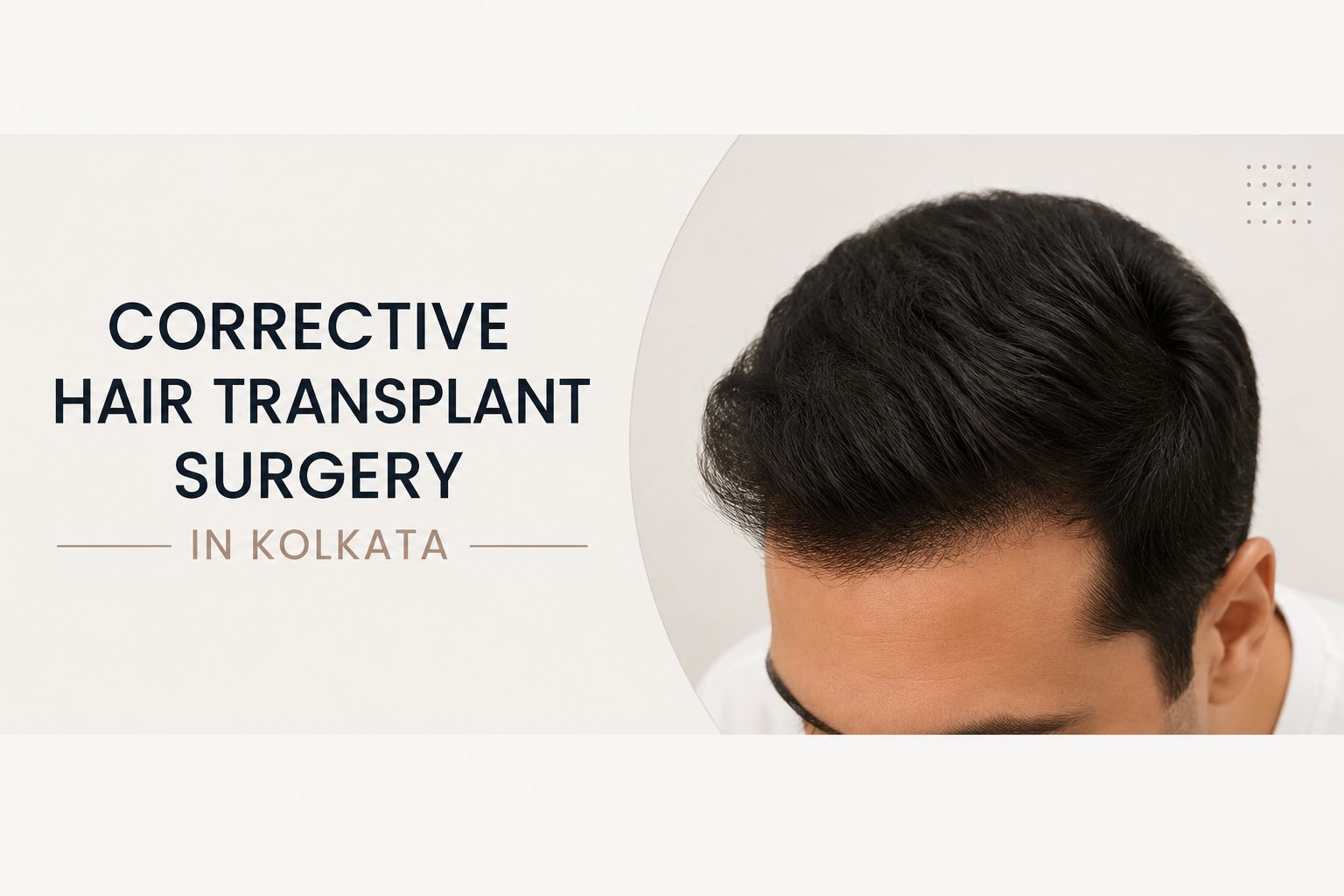 Corrective Hair Transplant