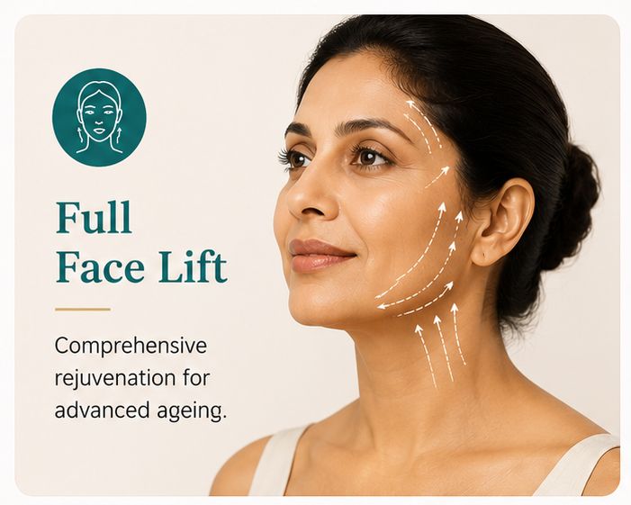 Full Face Lift